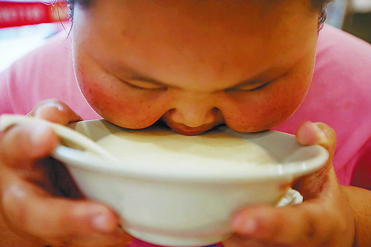UNICEF: Obesity overtakes being underweight among world's young