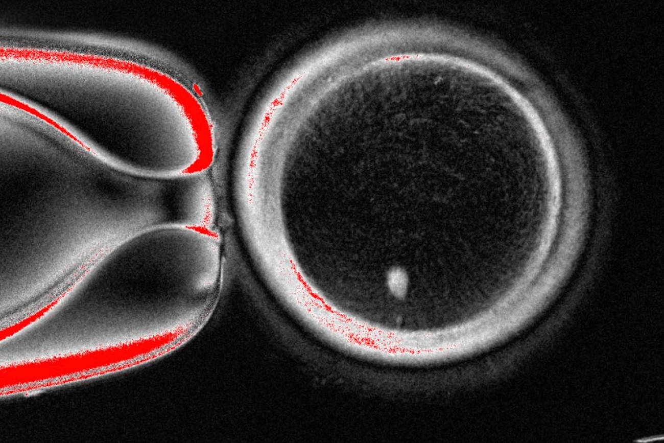 Scientists in early lab experiments use skin cells to create human eggs