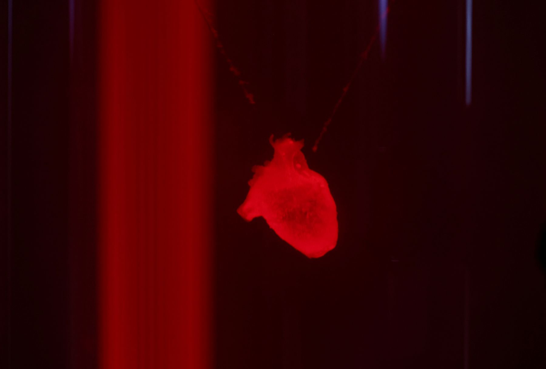 iPS 細胞の再生医療２製品、世界初承認へ　心不全とパーキンソン病の治療での実用化めざす